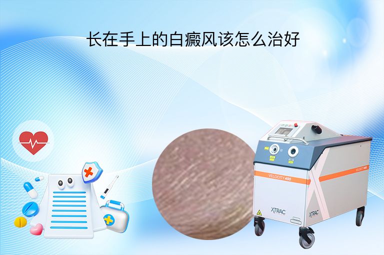 长在手上的白癜风该怎么治好”