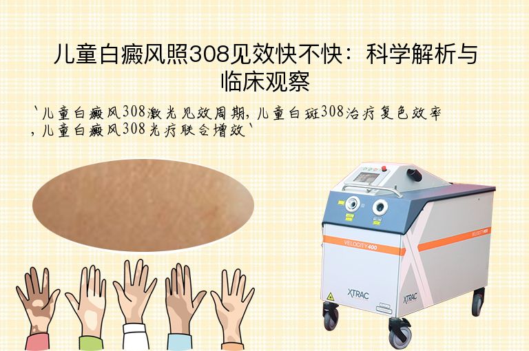 儿童白癜风照308见效快不快:科学解析与临床观察