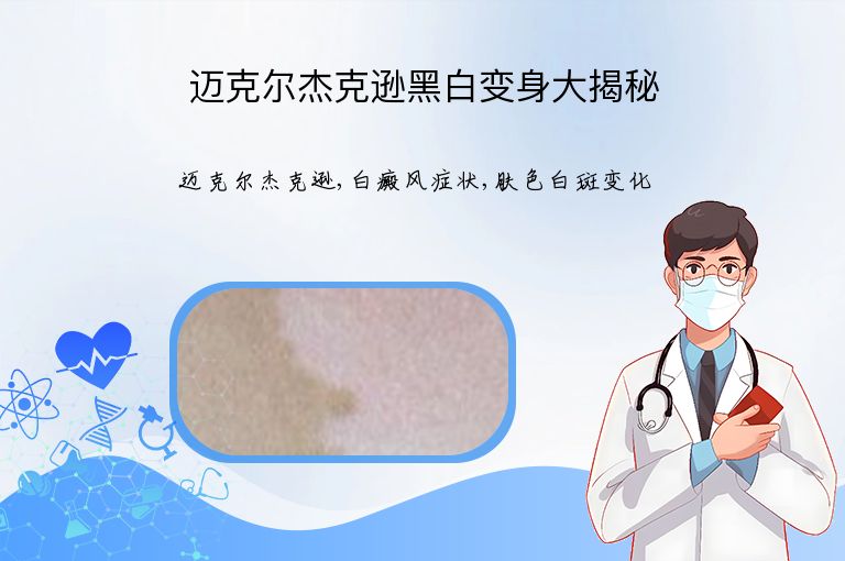 https://www.bdfsjzyy.com/d/file/p/1e9c7f174ae8075cb90eb3d9e783f7c7.jpeg