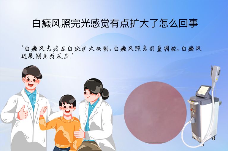 白癜风照完光感觉有点扩大了怎么回事”