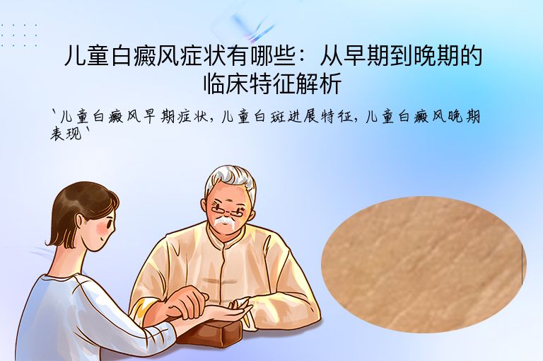 儿童白癜风症状有哪些：从早期到晚期的临床特征解析