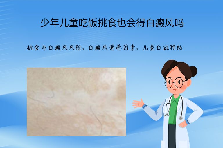 少年儿童吃饭挑食也会得白癜风吗”