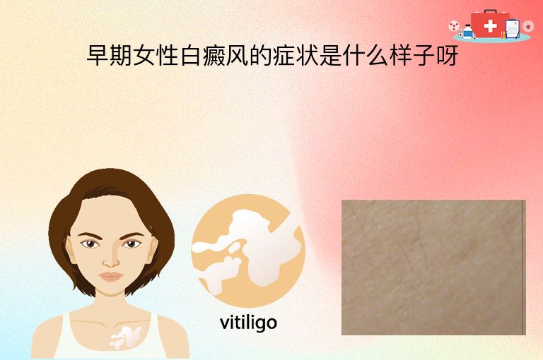 早期女性白癜风的症状是什么样子呀”