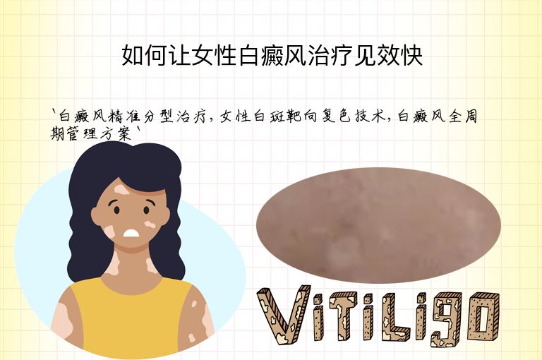 如何让女性白癜风治疗见效快”