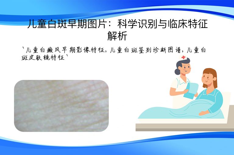 儿童白斑早期图片:科学识别与临床特征解析