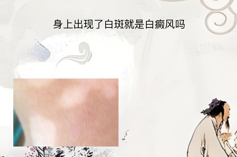 https://www.bdfsjzyy.com/d/file/p/9ce7947af020b9eb29df5d5d138cec02.jpeg