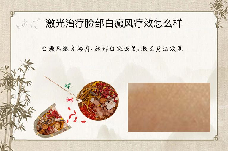 激光治疗脸部白癜风疗效怎么样”