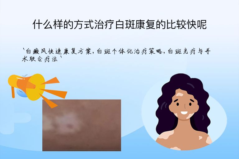 什么样的方式治疗白斑康复的比较快呢