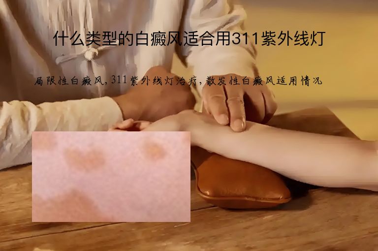 什么类型的白癜风适合用311紫外线灯”