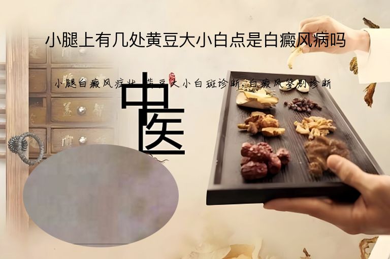 小腿上有几处黄豆大小白点是白癜风病吗”
