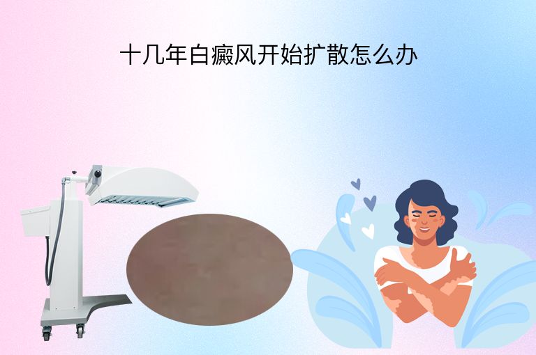 十几年白癜风开始扩散怎么办”
