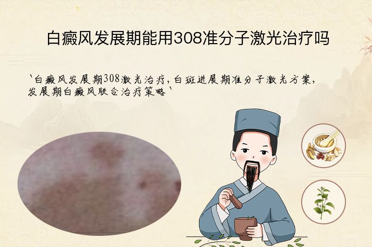 https://www.bdfsjzyy.com/d/file/p/9373e45ba644c1cfc01abe4741ab50e7.jpeg