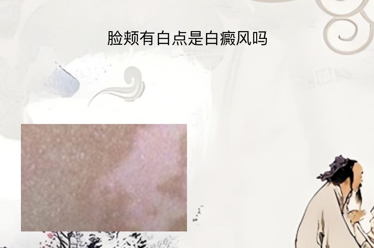 https://www.bdfsjzyy.com/d/file/p/c790c4275f794e97ce93d5e0834a18f1.jpeg