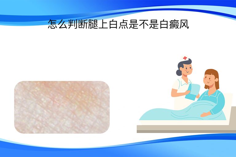 怎么判断腿上白点是不是白癜风”