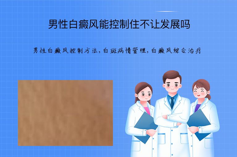 男性白癜风能控制住不让发展吗”