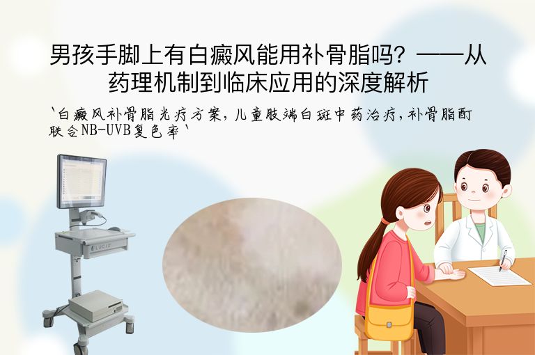 男孩手脚上有白癜风能用补骨脂吗？——从药理机制到临床应用的深度解析