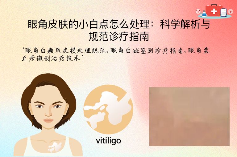 眼角皮肤的小白点怎么处理：科学解析与规范诊疗指南