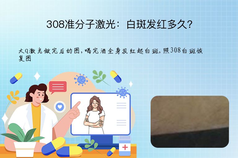 308准分子激光：白斑发红多久？”