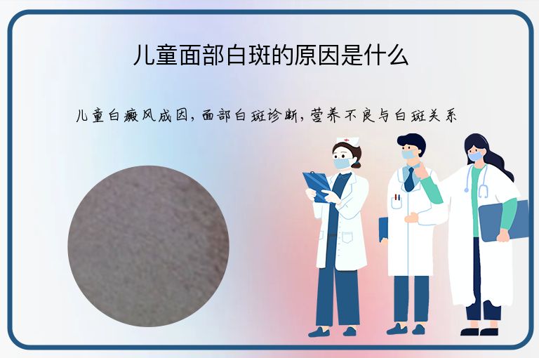 儿童面部白斑的原因是什么”