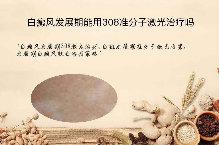 白癜风发展期能用308准分子激光治疗吗”