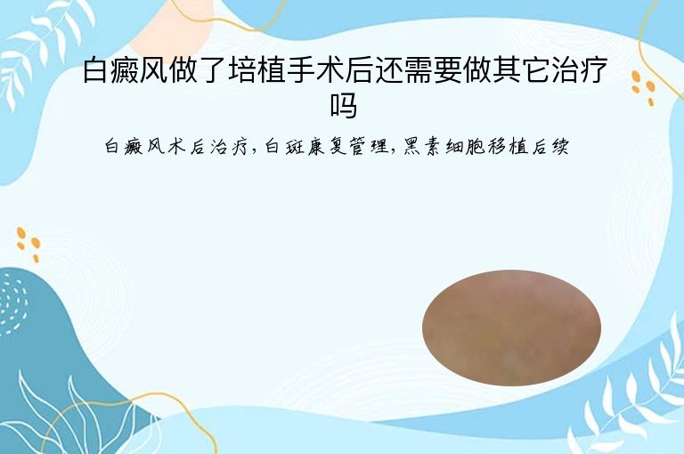 https://www.bdfsjzyy.com/d/file/p/0d10bf7a2ce2d9659de649c469c4c8d0.jpeg