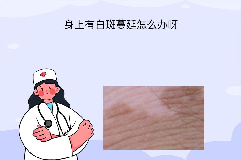 https://www.bdfsjzyy.com/d/file/p/54456a448c1965de93b057adf6d6722e.jpeg