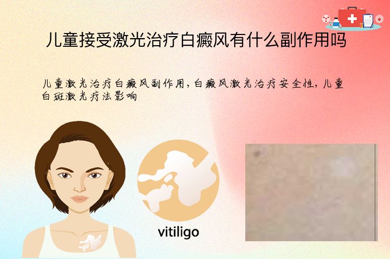 儿童接受激光治疗白癜风有什么副作用吗”