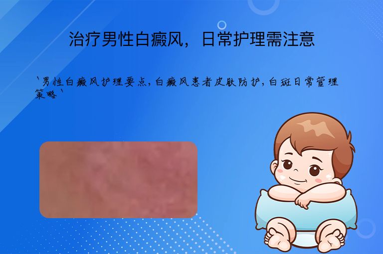 治疗男性白癜风，日常护理需注意