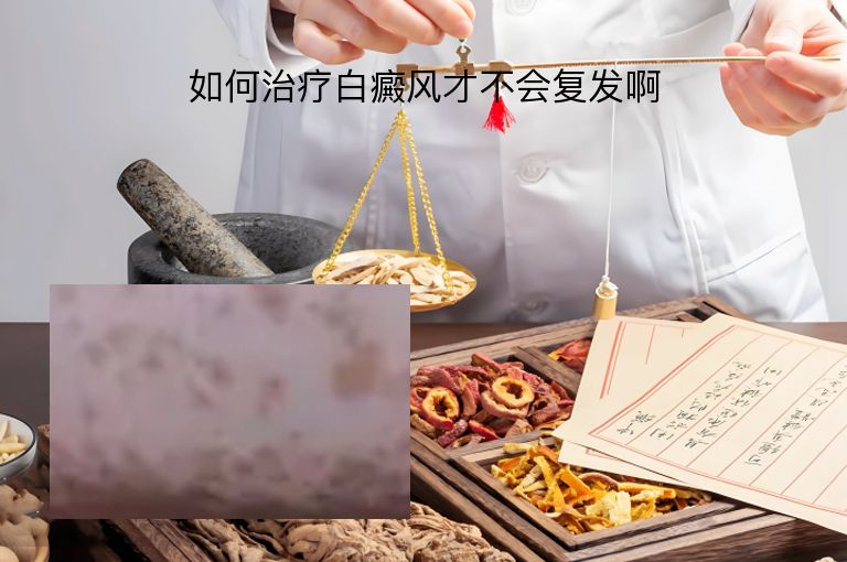 https://www.bdfsjzyy.com/d/file/p/13cec2e71dd1d78c90e33d462bf0fa3e.jpeg