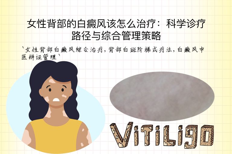 女性背部的白癜风该怎么治疗:科学诊疗路径与综合管理策略