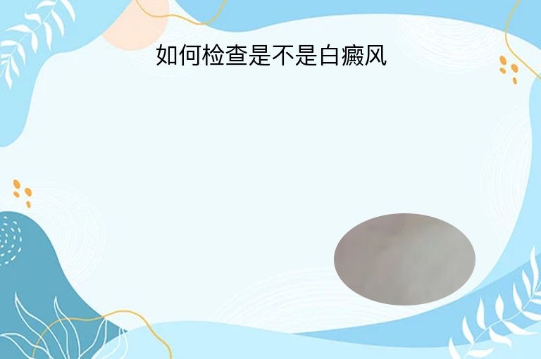 如何检查是不是白癜风