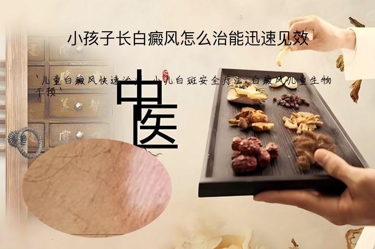 小孩子长白癜风怎么治能迅速见效”