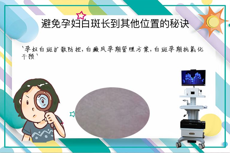 避免孕妇白斑长到其他位置的秘诀