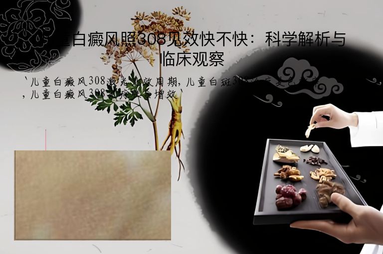 儿童白癜风照308见效快不快:科学解析与临床观察