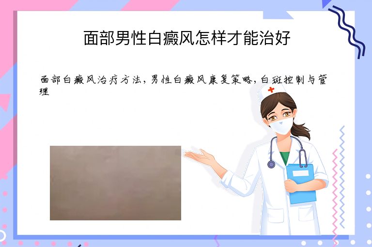 面部男性白癜风怎样才能治好”
