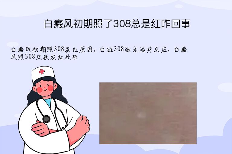 白癜风初期照了308总是红咋回事”