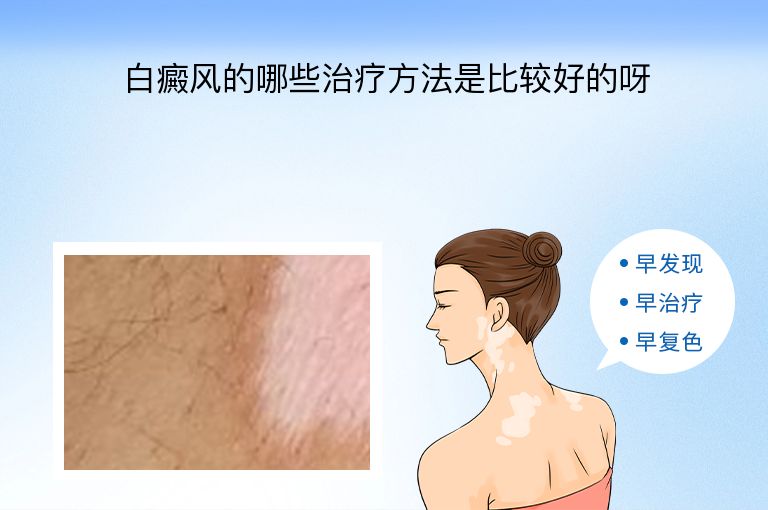 https://www.bdfsjzyy.com/d/file/p/6a74e7331843a8a3ad1058caedf4a12e.jpeg