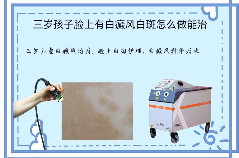 https://www.bdfsjzyy.com/d/file/p/0e243380bae35c2a7df5d1f94f4c5604.jpeg