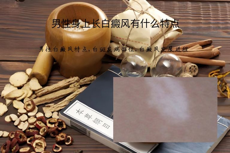 男性身上长白癜风有什么特点”