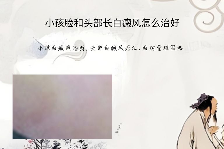 小孩脸和头部长白癜风怎么治好”