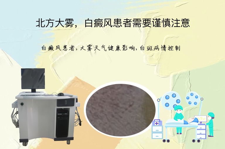 北方大雾,白癜风患者需要谨慎注意”