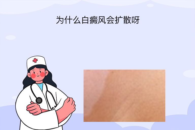 为什么白癜风会扩散呀”