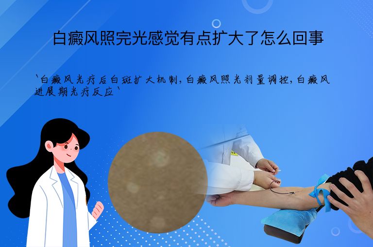 白癜风照完光感觉有点扩大了怎么回事”