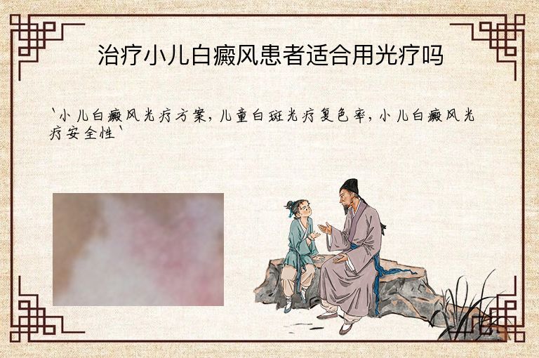 治疗小儿白癜风患者适合用光疗吗