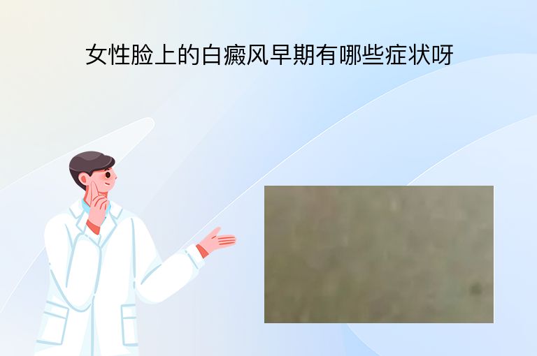 女性脸上的白癜风早期有哪些症状呀