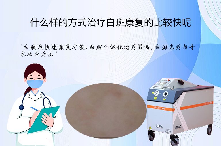 什么样的方式治疗白斑康复的比较快呢