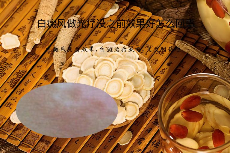 白癜风做光疗没之前效果好怎么回事”