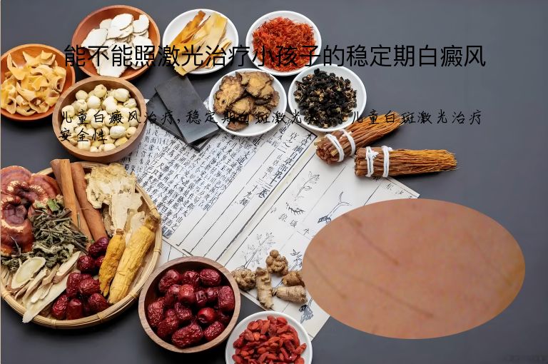 能不能照激光治疗小孩子的稳定期白癜风”