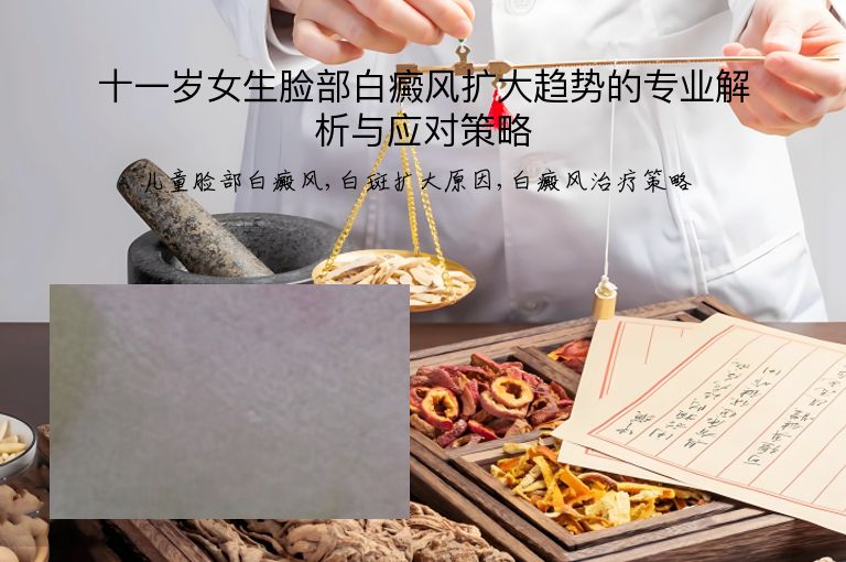 十一岁女生脸部白癜风扩大趋势的专业解析与应对策略”