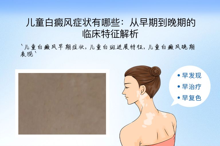 儿童白癜风症状有哪些:从早期到晚期的临床特征解析